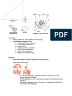 Barrier Method