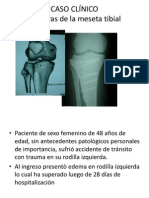 Fracturas Meseta Tibial