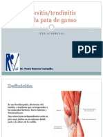 Tendinitis de La Pata de Ganso PRV