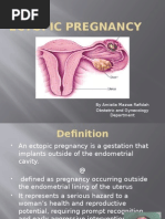 Ectopic Pregnancy: by Amielia Mazwa Rafidah Obstetric and Gynecology Department