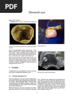 Dermoid Cyst