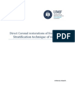 Direct Composite Restorations Stratification