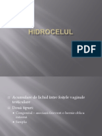 Hidrocel Varicocel