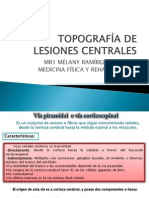 Topografía de Lesiones Centrales