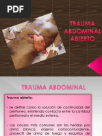 Traumatismo Abdominal