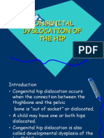 Congenital Dyslocation of The Hip