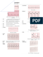 ECG Interpretation