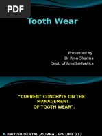 Tooth Wear