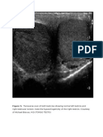 Gambar Usg Testis