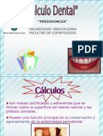 Calculo Dental