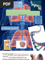 Fibrosis Quística (Diapositivas)