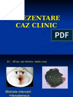 Caz Clinic HDS Varice