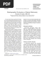 Radiographic Evaluation of Spinal Deformity PDF