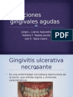 Infecciones Gingivales Agudas