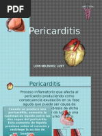 Pericarditis