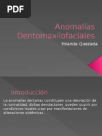 Anomalias Dentomaxilares