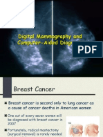 Breast Cancer