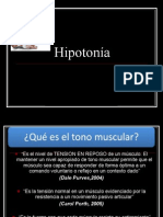 Hipotonía