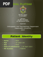 Tibial Plateau Powerpoint