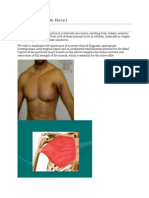 Pectoralis Major Rupture