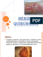 Herida Quirurgica