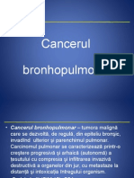 Cancerul Pulmonar Lectia