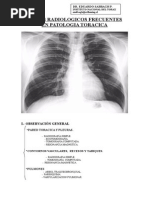 Signos Radiologicos Frecuentes