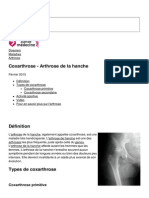 Coxarthrose Arthrose de La Hanche 834 Njwv1m