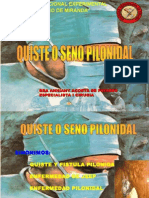 Quiste Pilonidal