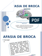 Afasia de Broca