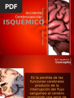 Accidente Cerebrovascular Isquémico