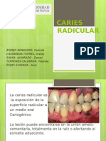 CARIES-RADICULAR-2 Expo