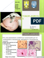 Toxoplasmosis