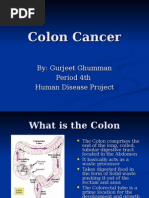 Colon Cancer