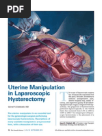 Laparascopic Uterine Elevator