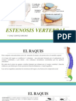 Estenosis Vertebral