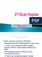 CT Scan Kepala