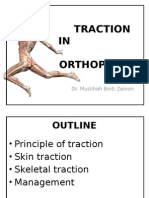 Traction in Orthopaedics - Mus'