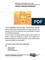 Protesis Fija PRUEBA DE LA ESTRUCTURA METÁLICA