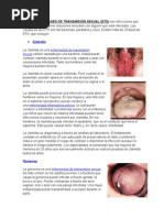 Las Enfermedades de Transmisión Sexual