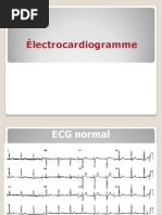 Ecg