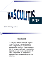 Vasculitis