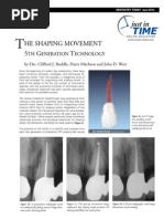 Niti Files in Endodontics