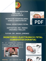 Monitoreo Fetal