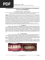 Prosthodontic Restoration of Vertical Dimension of Occlusion in Severly Worn Dentitions