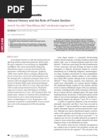 Acute Fungal Sinusitis Natural History and The Role of Frozen Section