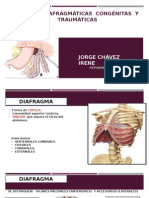 Hernia Diafragmatica Congenita