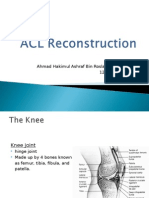 Anterior Cruciate Ligament Injuries