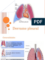 Derrame Pleural