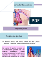 Angina de Pecho